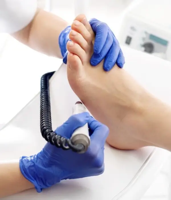 The foot and hands of a podiatrist performing a medical procedure